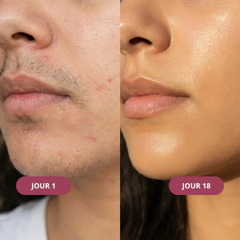 Rituel Trio Anti-repousse Meloria