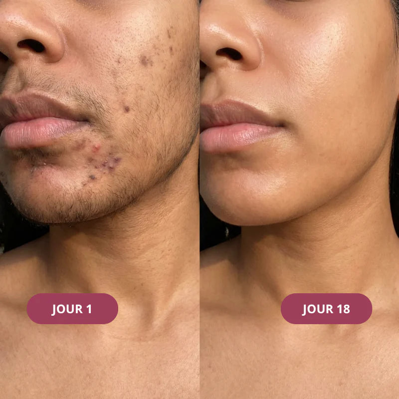 Rituel Trio Anti-repousse Meloria