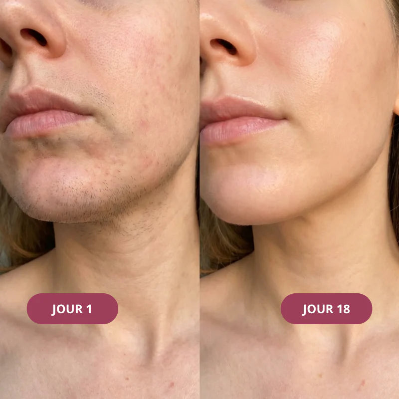 Rituel Trio Anti-repousse Meloria