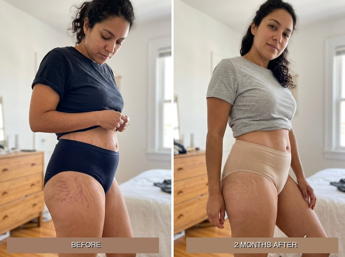 Before / 2 months after